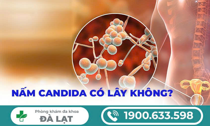 Hình ảnh minh họa